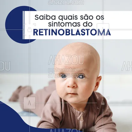 posts, legendas e frases de assuntos variados de Saúde e Bem-Estar para whatsapp, instagram e facebook: O retinoblastoma, ou câncer ocular, acomete em grande maioria as crianças de 2 a 5 anos.
Os sinais mais comuns de sintomas para identificar esse tipo de tumor incluem:
- Reflexo branco na pupila
- Sensibilidade a luz - Fotofobia;
- Dificuldade visual;
- Estrabismo;
- Proptose. #AhazouSaude #bemestar  #cuidese  #qualidadedevida  #saude  #viverbem 