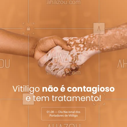 posts, legendas e frases de posts para todos para whatsapp, instagram e facebook: Dia dos Portadores de Vitiligo: apoie a causa contra o preconceito! ?
#ahazou #ahazou #frasesmotivacionais  #motivacionais #perfctskin #pele #skin #vitiligo