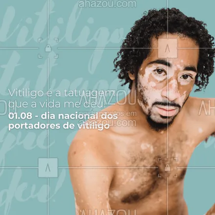 posts, legendas e frases de posts para todos para whatsapp, instagram e facebook: Vitiligo não é contagioso, o preconceito é! Dia nacional dos portadores de vitiligo. ??
#ahazou #frasesmotivacionais  #motivacionais #perfectskin #pele #skin #vitiligo