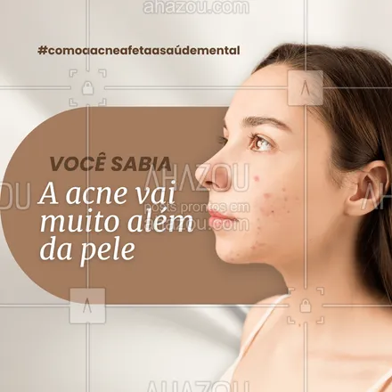 posts, legendas e frases de posts para todos para whatsapp, instagram e facebook: A acne vai muito além de espinhas. Ela pode afetar profundamente nossa autoestima e saúde mental.  As marcas na pele podem se transformar em cicatrizes emocionais.  É hora de falar sobre isso!  
#acne #saudemental #autoestima #beleza #ahazou #tendência 