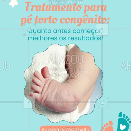 posts, legendas e frases de para whatsapp, instagram e facebook: A maioria dos casos de pé torto congênito pode ser tratada com técnicas simples e eficazes, como o método de Ponseti.
Quanto mais cedo iniciar, maiores as chances de correção completa.
Estamos aqui para cuidar com carinho!
#pétortocongenito #metododeponseti #recemnascido #tratamentoinfantil #saudebebe #ortopedia #cuidadoscomobebe