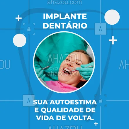 posts, legendas e frases de odontologia para whatsapp, instagram e facebook: Nossa prioridade é ver você sorrindo com muita segurança e devolver sua autoestima. E com o implante dentário você vai ter um milhão de motivos para sorrir. Então não espere mais, entre em contato 📞 (inserir número) e agende seu horário. #bemestar #odonto #odontologia #AhazouSaude #saude #bemestar #autoestima #qualidadedevida #sorrir #implante #implantedentario 