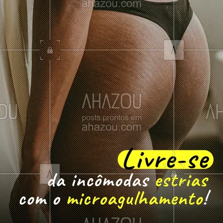 posts, legendas e frases de estética corporal para whatsapp, instagram e facebook: O procedimento é feito por meio do dermaroller e você já consegue ver resultados após a primeira sessão. 
#microagulhamento #dermaroller #estrias #AhazouBeauty #estetica  #esteticacorporal  #esteticaavançada 

