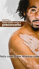 1 de agosto. Dia nacional dos portadores de vitiligo - OncoExpress